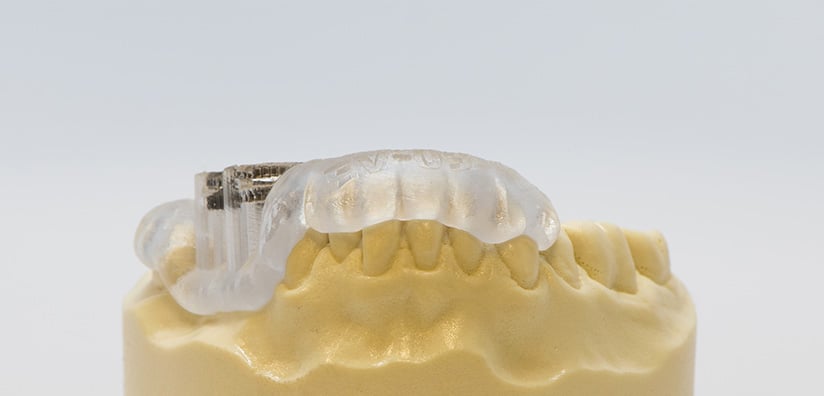 AN INTRODUCTION TO SURGICAL GUIDES IN DENTISTRY